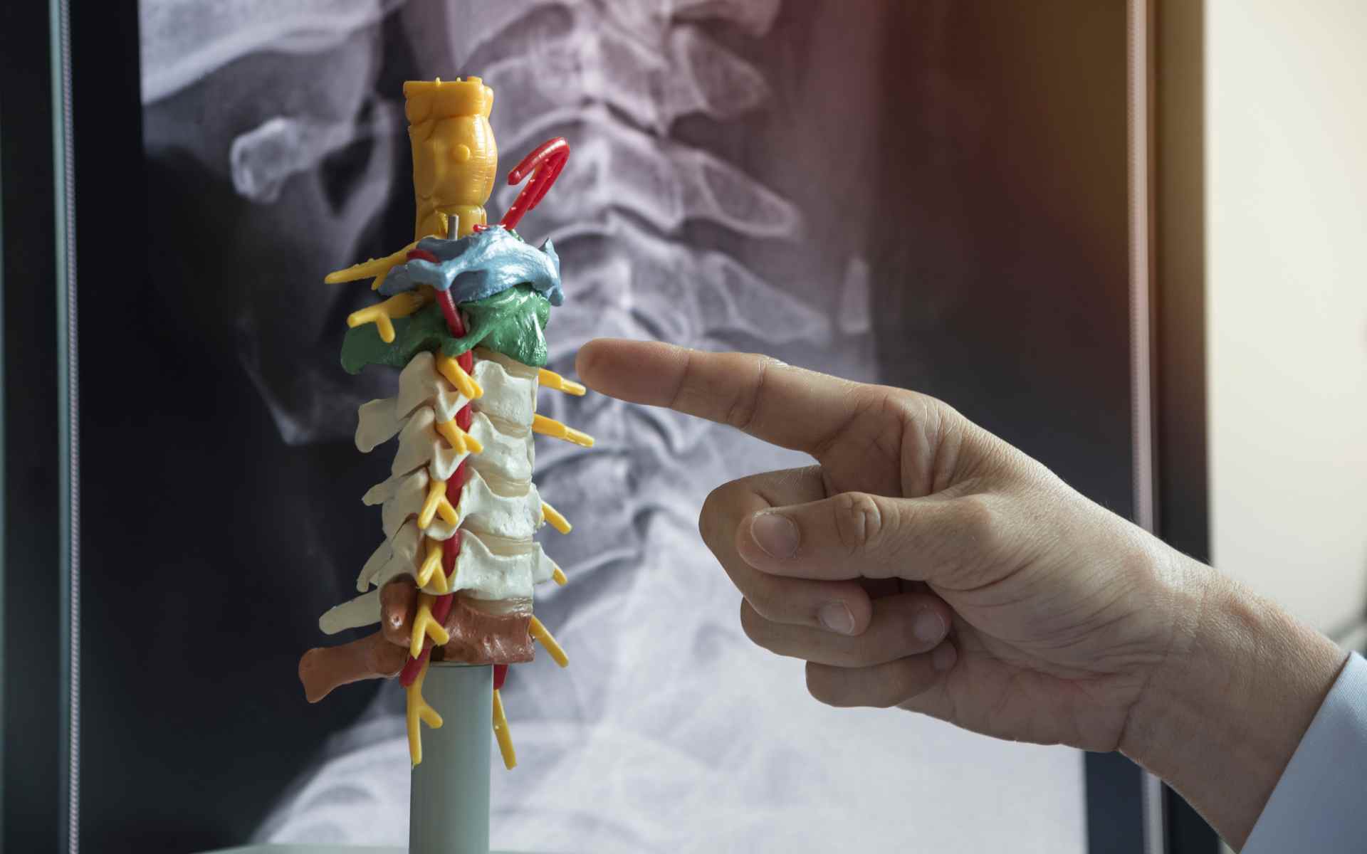 Artrosi cervicale sintomi iniziali - trattamento Fisiotesta Napoli