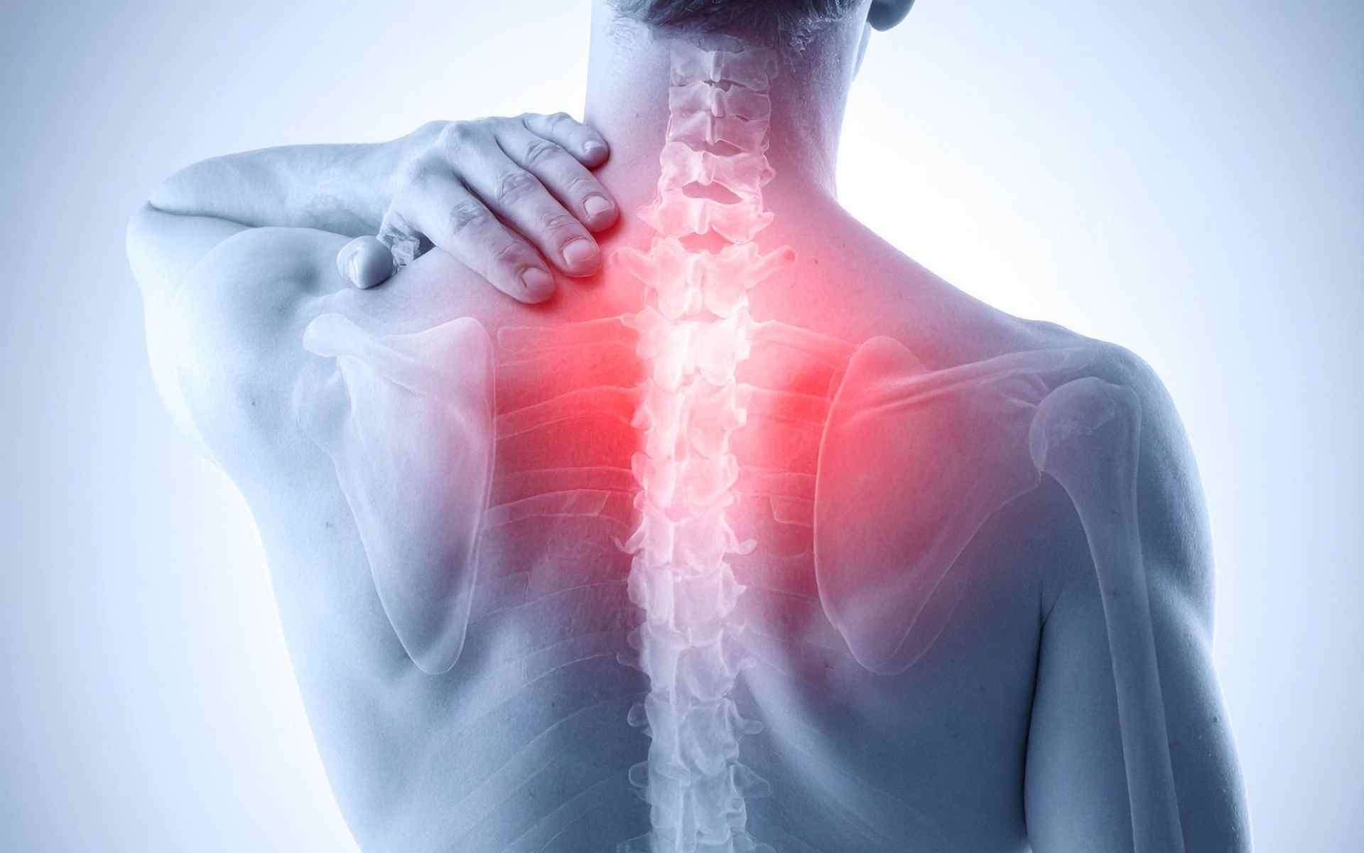 Anatomia colonna vertebrale dorsale con evidenziazione dolori schiena alta e trigger points muscolari
