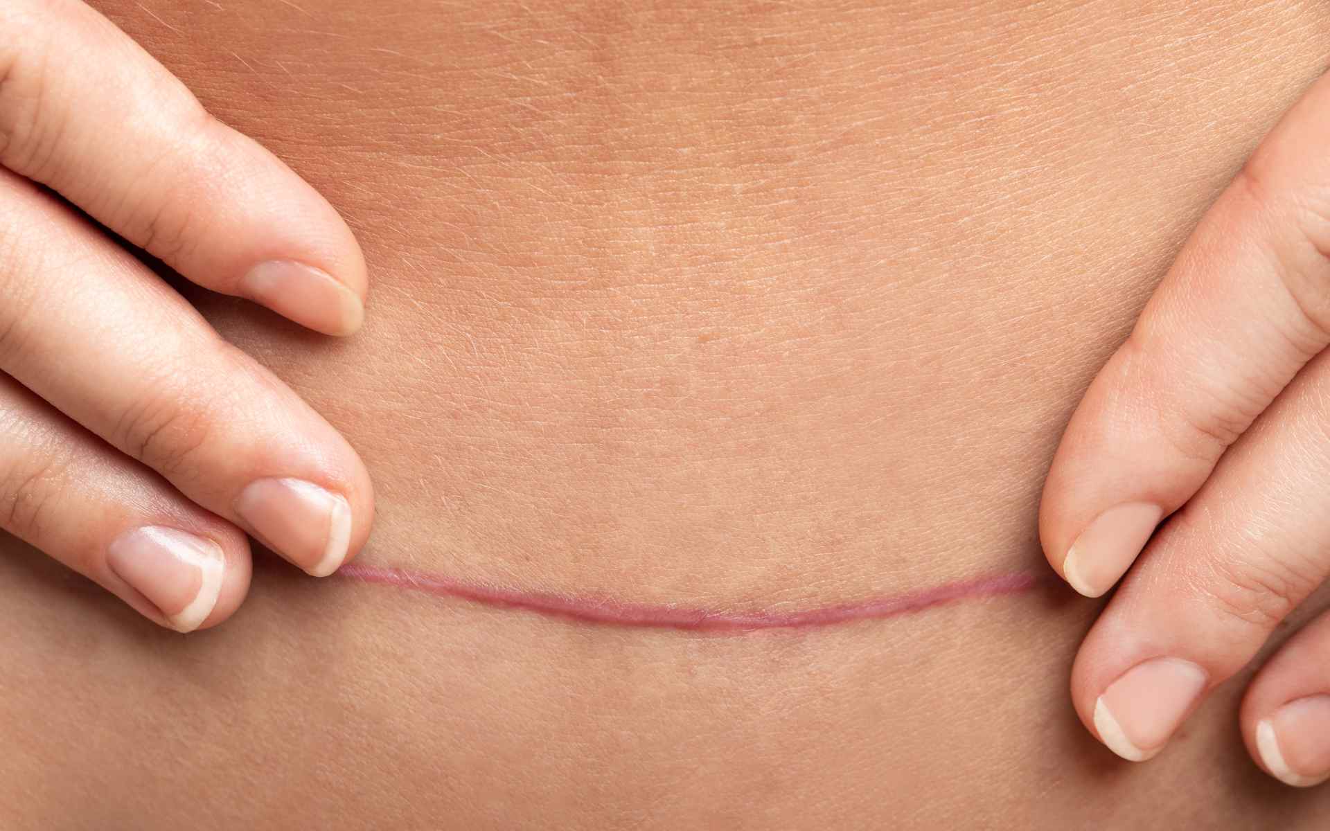 Dolori post parto rimedi naturali - Centro Fisioterapia Testa Napoli