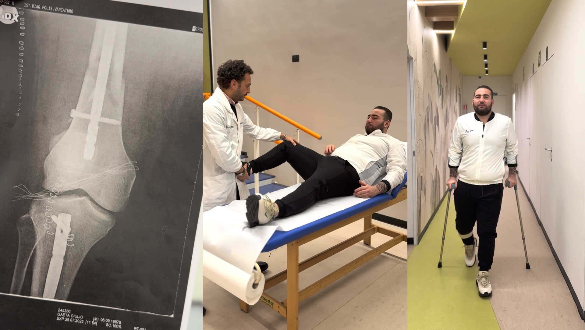 Giulio durante la riabilitazione post politrauma bilaterale presso il centro Fisiotesta di Lago Patria